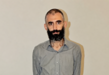 Gürkan Türkoğlu Ölüm Döşeğinde Zorla Müdahale Suçtur, Cezalandırılmalıdır!